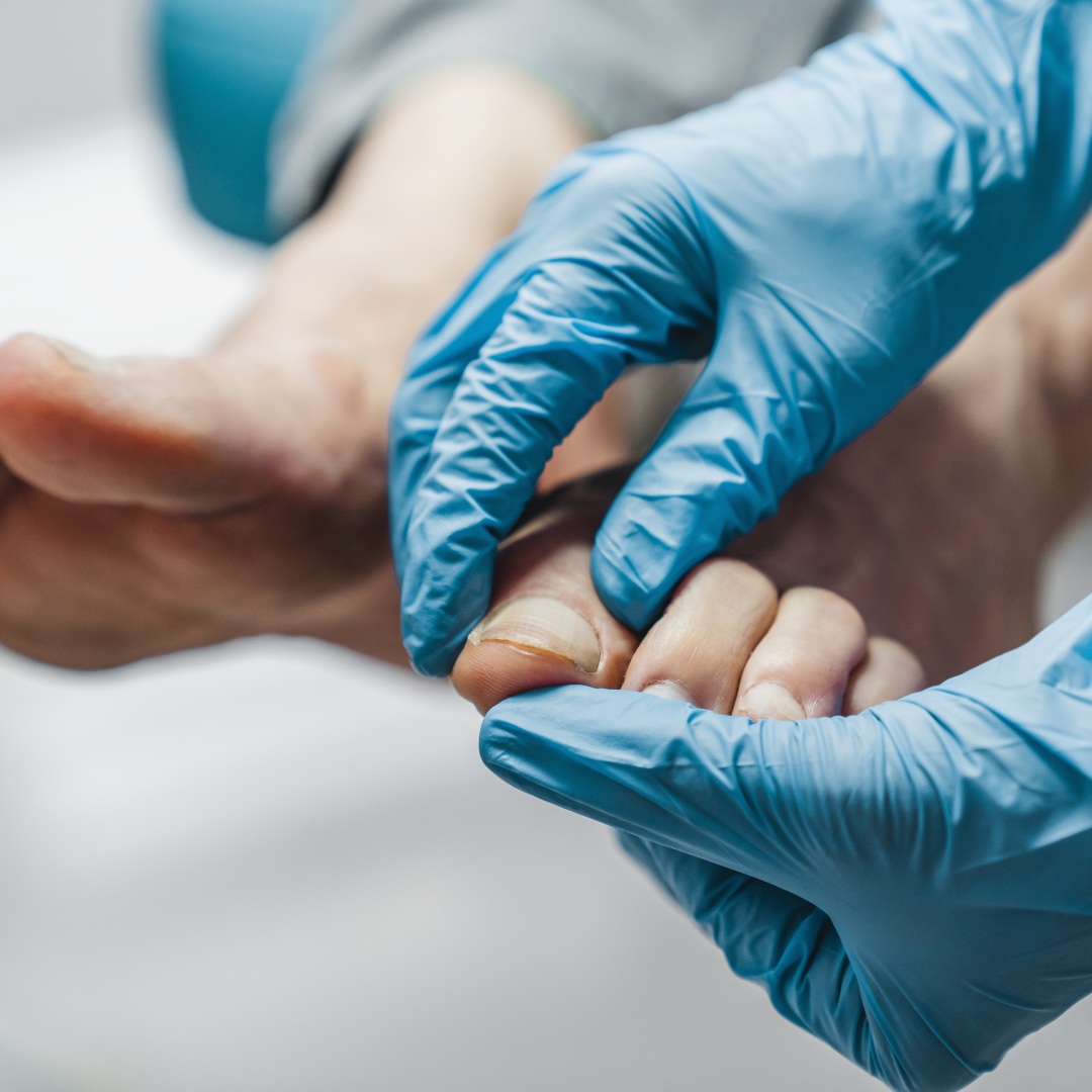 Hands wearing blue gloves checking feet