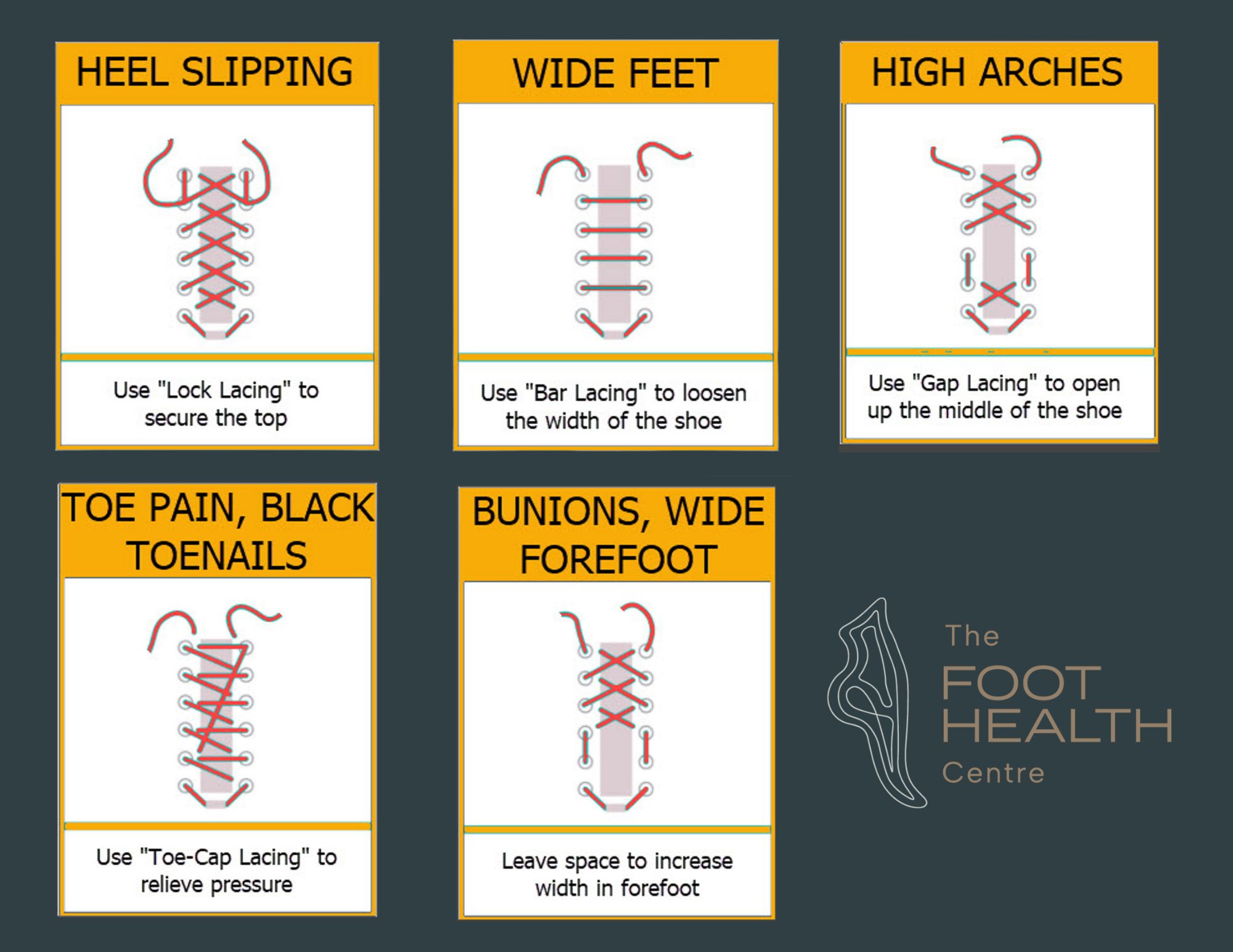 Common Shoe Lacing Techniques