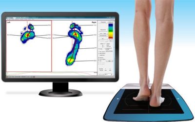 Why We Don’t Rely on Pressure Mapping for Orthotics: What You Need to Know