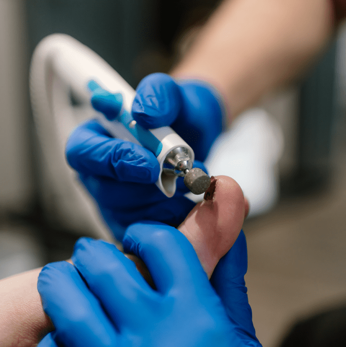 Does a Chiropodist Do Pedicures?